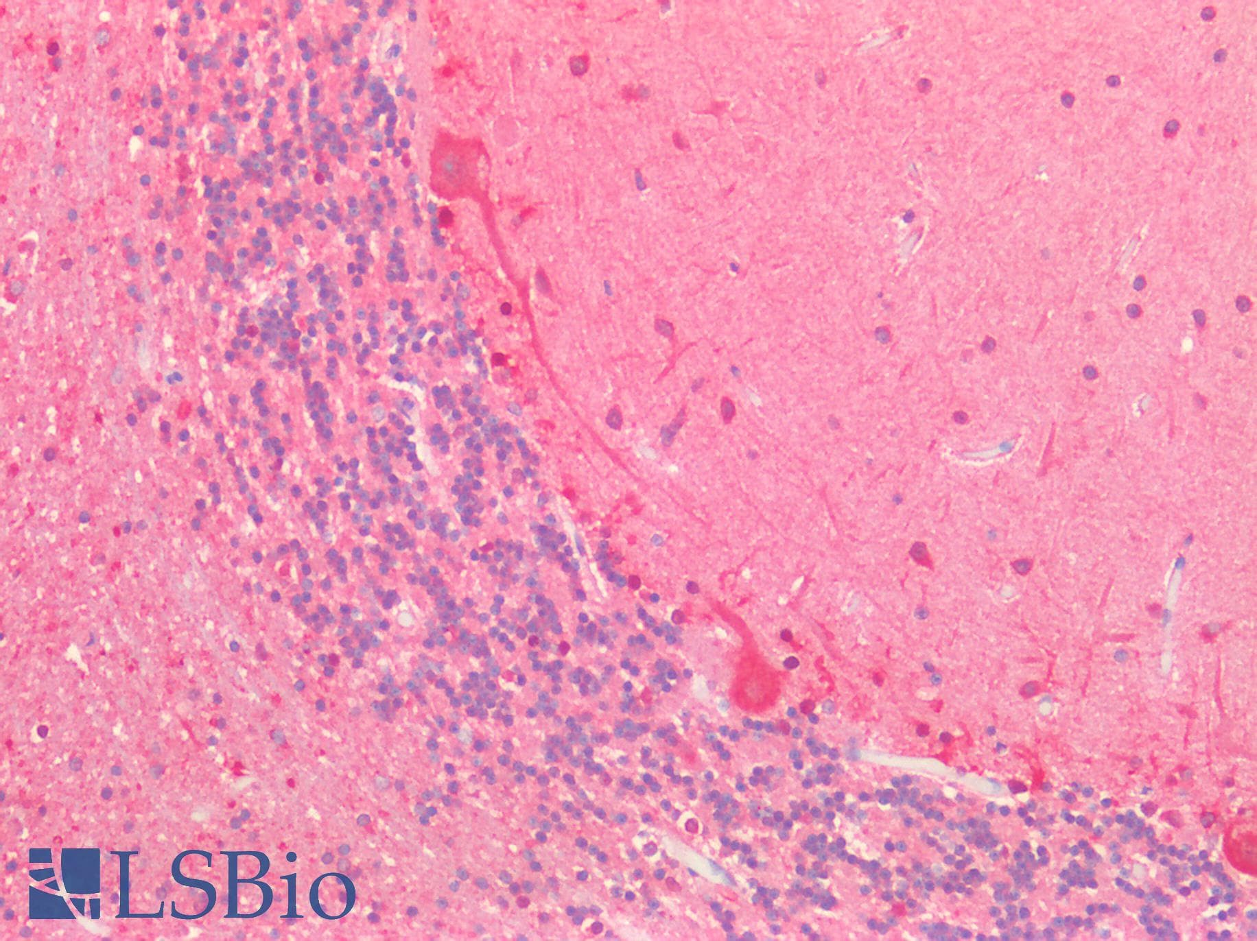 Polyclonal Rabbit anti-Human VARS2 / ValRS Antibody (IHC, WB)