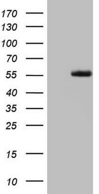 LRRTM1 Antibody (aa182-422, clone OTI5H9)