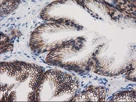 CTNNB1 / Beta Catenin Antibody (clone OTI9F6)