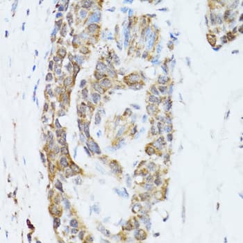 TOLLIP Antibody