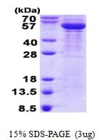 Human TUBB3 / Tubulin Beta 3 Protein (Recombinant His)