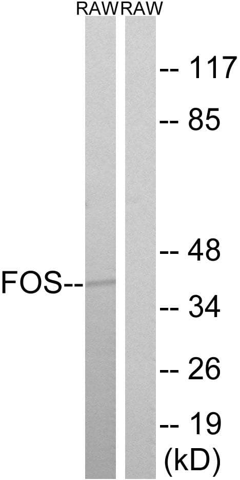 FOS / c-FOS Antibody (p32)