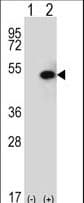 Polyclonal Rabbit anti-Human SPHK / SPHK1 Antibody (aa313-343, IHC, WB)