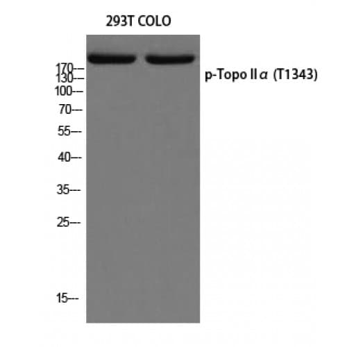Polyclonal Rabbit anti-Human TOP2A / Topoisomerase II Alpha Antibody (1280-1360 aa, WB)