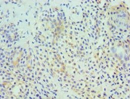 Polyclonal Rabbit anti-Human HDAC6 Antibody (aa160-470, IHC)