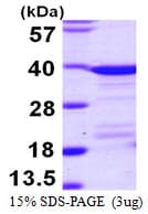 Human EEF1D Protein (Recombinant His)