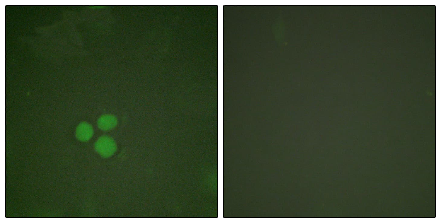 Polyclonal Rabbit anti-Human TFDP1 Antibody (aa361-410, IHC, IF, WB)