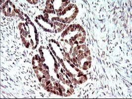 PMS2 Antibody (clone OTI2G5)
