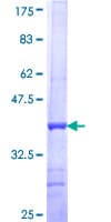 Human FUT2 / SE Protein (Recombinant GST, N-terminus)