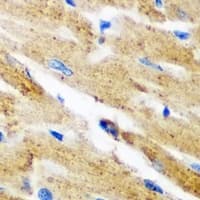 KYNU Antibody