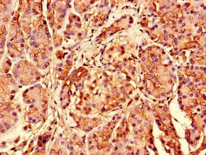 Polyclonal Rabbit anti-Human S26 / RPS26 Antibody