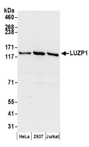 Polyclonal Rabbit anti-Human LUZP1 Antibody (aa1-50, WB)