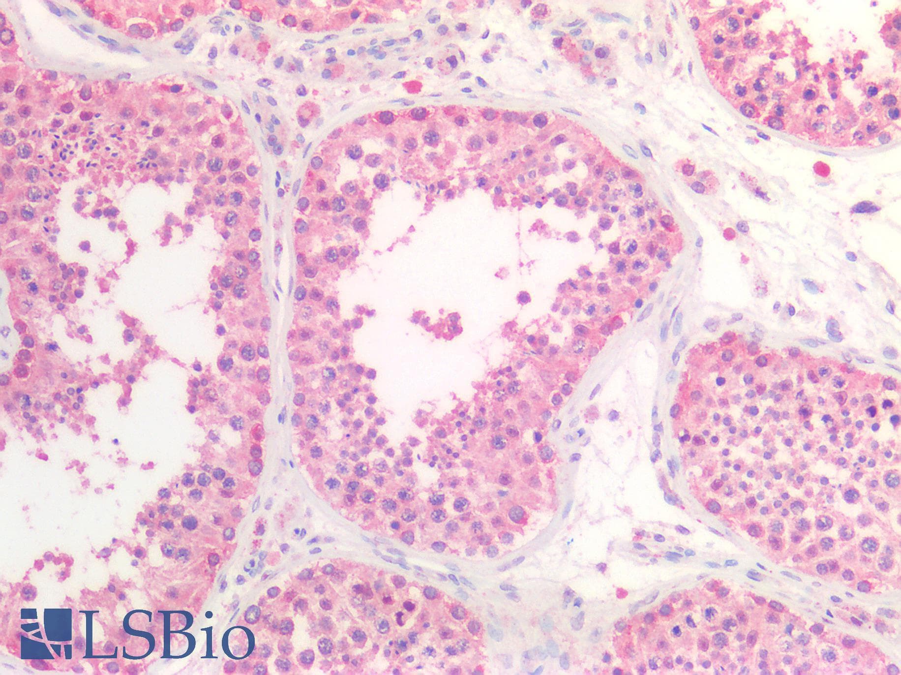 IHC-plus™ HSPA8 / HSC70 Antibody (Isoform 1)
