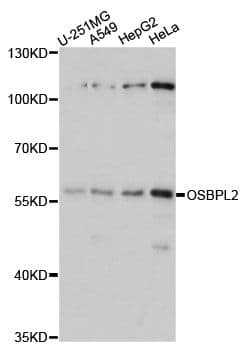 Polyclonal Rabbit anti-Human OSBPL2 Antibody (WB)