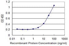 Monoclonal Mouse anti-Human DGKA Antibody (clone 2B7, IHC)