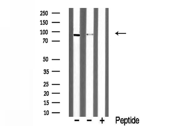 Polyclonal Rabbit anti-Human DYRK / DYRK1A Antibody (IF, WB)