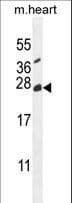 Polyclonal Rabbit anti-Human TNFAIP8L2 Antibody (aa29-58, WB)