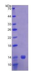 Human CAP1 Protein (Recombinant His)