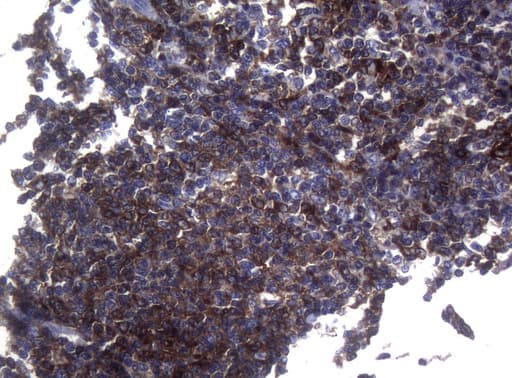 Monoclonal Mouse anti-Human SAMSN1 Antibody (clone OTI7D12, Carrier-free, aa1-250, IHC, WB)