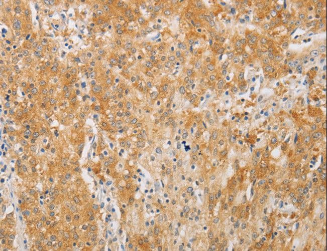 Polyclonal Rabbit anti-Human PDE4D Antibody (IHC, WB)