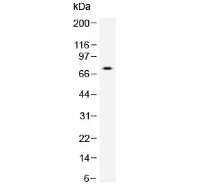 Polyclonal Rabbit anti-Human MMP2 Antibody (WB)