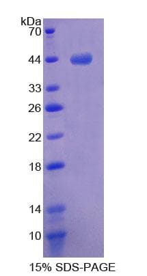 Mouse MTPN / Myotrophin Protein (Recombinant His-T7)