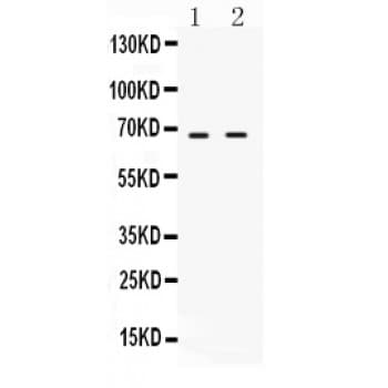BIRC3 / cIAP2 Antibody (aa1-191)