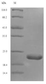 Mouse TXNDC12 Protein (Recombinant 6His, N-terminus)