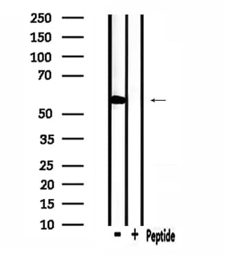 STK32C / PKE Antibody