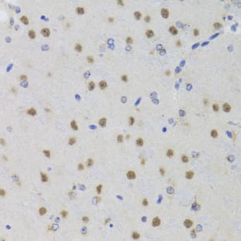 SMYD1 Antibody