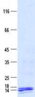 Human C12orf77 Protein (Recombinant His, N-Terminal)
