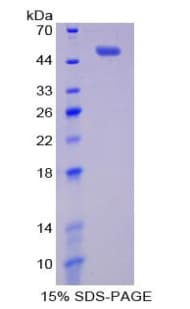 Rat BAFF Receptor / CD268 Protein (Recombinant His-GST)