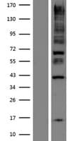 KANK1 Protein (Over-Expression Lysate Myc-DDK (Flag))