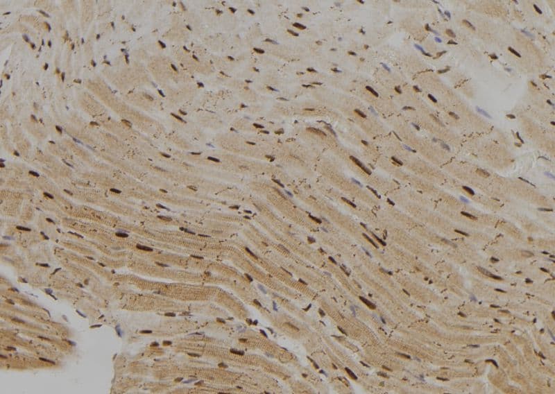 KHSRP / FBP2 Antibody