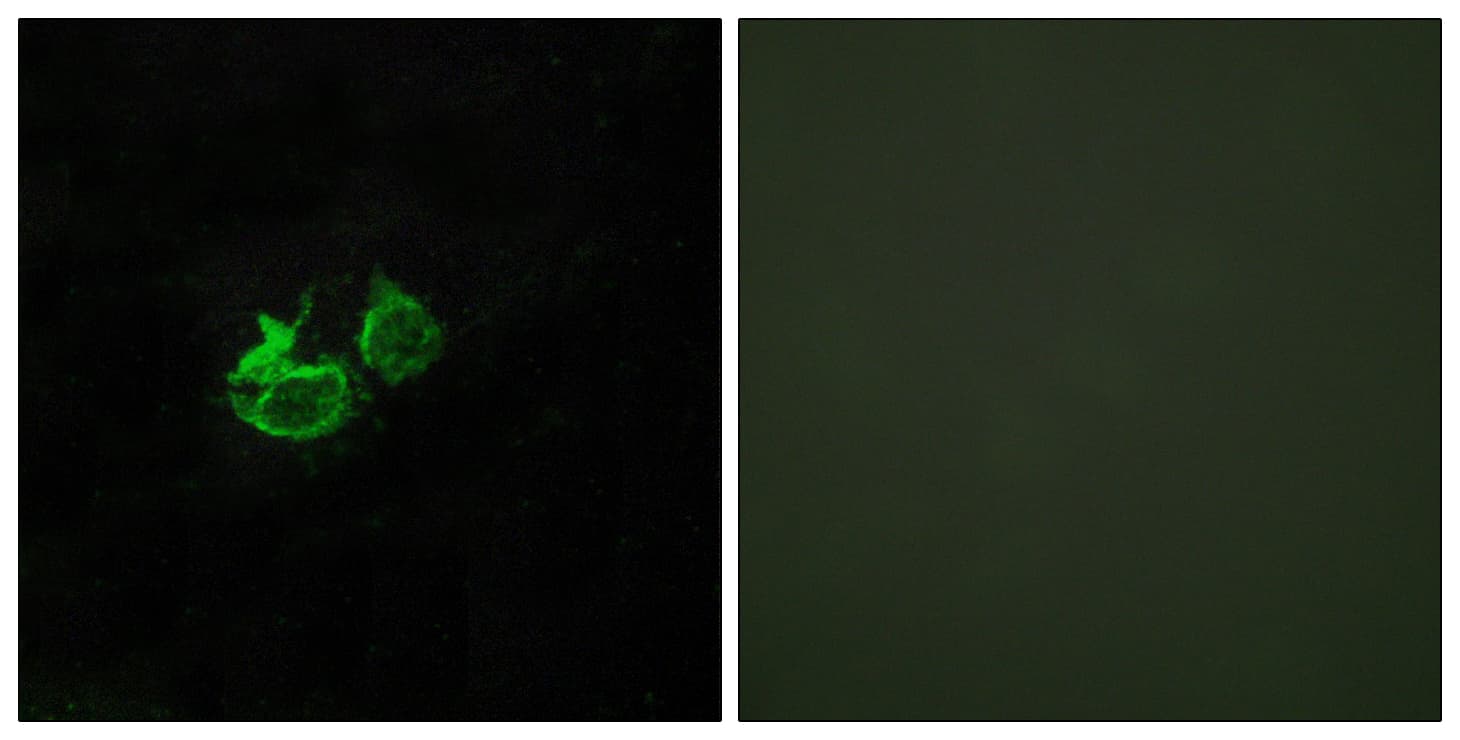IHC-plus™ GHRHR Antibody (aa351-400)