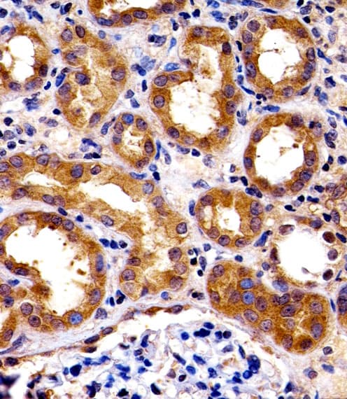 Polyclonal Rabbit anti-Human SPHK / SPHK1 Antibody (aa59-89, IHC, WB)