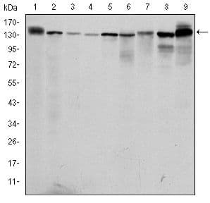 PKN2 Antibody (clone 1D1)