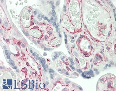 IHC-plus™ IFITM5 Antibody (aa55-83)