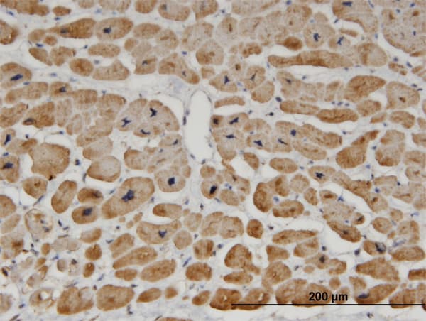 ZNF239 Antibody (clone 2D9)