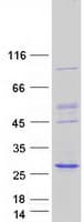 Human NKIRAS2 Protein (Recombinant Myc-DDK (Flag))