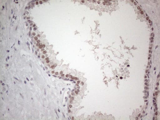 TDG / Thymine DNA Glycosylase Antibody (aa160-253, clone OTI3C11)