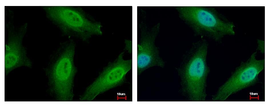 NUP62 Antibody (aa230-490)
