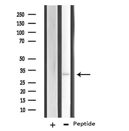 RNF144B Antibody