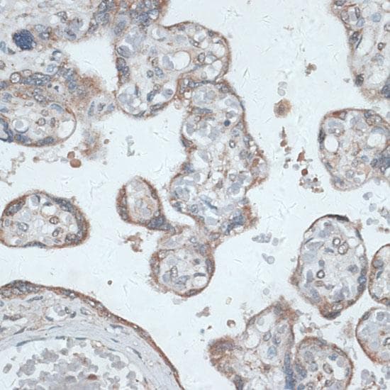 TMEPAI / PMEPA1 Antibody