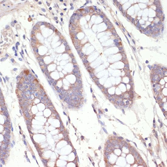 HMG-CoA Reductase / HMGCR Antibody