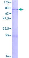 Human TBL2 Protein (Recombinant GST)