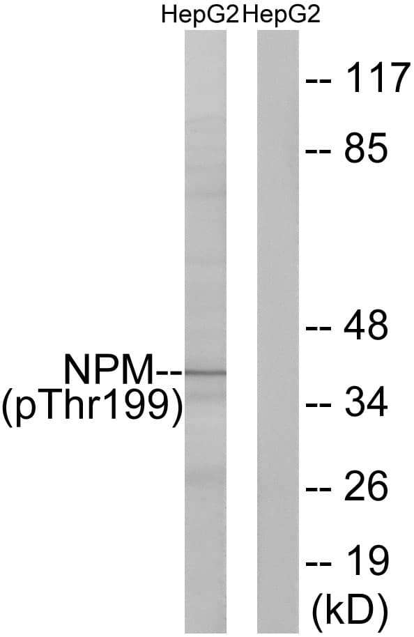 Polyclonal Rabbit anti-Human NPM1 / NPM / Nucleophosmin Antibody (phospho-Thr199, IHC, IF, WB)
