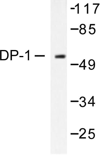 Polyclonal Rabbit anti-Human TFDP1 Antibody (Val393, IHC, IF, WB)