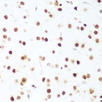 CDK1 / CDC2 Antibody