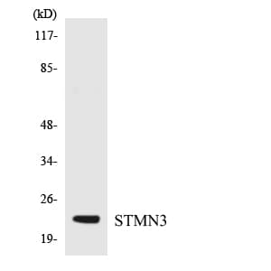 SCLIP / STMN3 Antibody (aa45-94)